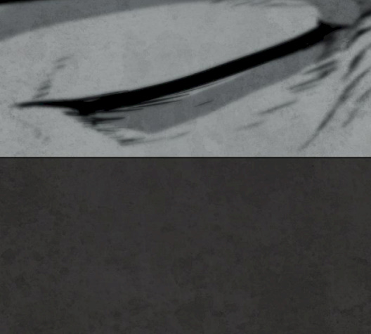 White Blood Ch.37 p246